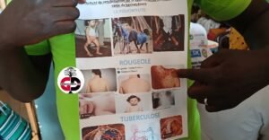 Kankan : l'ONG Santé Optimale Guinée, en campagne de sensibilisation sur la vaccination dans les centres de santé.