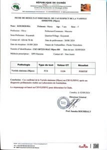 Urgent/ Guinée : le premier cas de la variole du singe MPOX, confirmé ( source médicale)