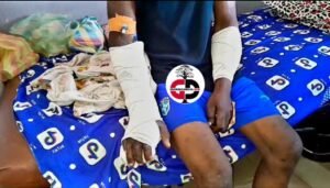 Affrontement à Gbérédou Baranama : Un rescapé se confie « Ils voulaient nous tuer, nous avons fait semblant d’être morts »