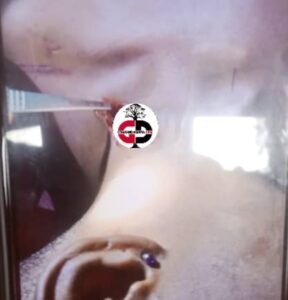 Siguiri : Une jeune fille poignardée par son ex copain à Sininkoba (Raisons) 5 Siguiri : Une jeune fille poignardée par son ex copain à Sininkoba (Raisons)