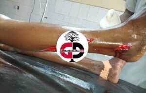 Doko (Siguiri) : Une mère de famille décapitée par un homme, pour avoir frappé son enfant.