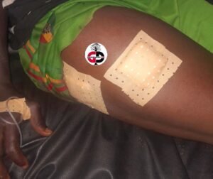 Attaque à Doko (Siguiri) : Des individus non identifiés tirent sur un orpailleur avant d'emporter sa machine et l'or.