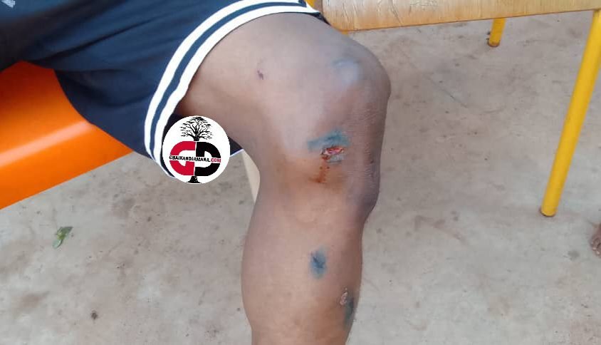 Urgent / attaque à main armée à Kourémalé : « Il a tiré à l'air et jai laissé la machine »