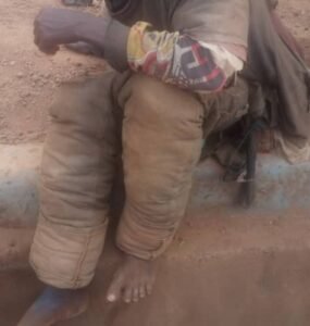 Faranah : La présence massive des personnes en détresse mentale crée de la panique dans la cité. 4 Faranah : La présence massive des personnes en détresse mentale crée de la panique dans la cité.