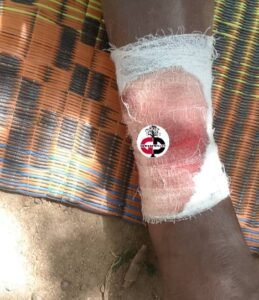 Kérouané : Les chiens dictent leur loi sur la population à Gbenko, plusieurs citoyens victimes de morsures