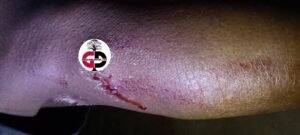 Kérouané : Les chiens dictent leur loi sur la population à Gbenko, plusieurs citoyens victimes de morsures