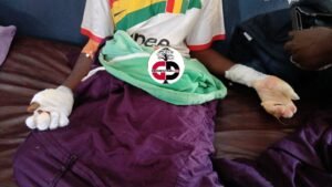 Urgent / Kankan : Un incendie ravage une maison et son contenu, deux personnes gravement blessées. 