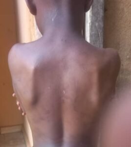 Popodara – Labé : Un maître coranique poursuivi pour avoir maltraité son élève (témoignage) 