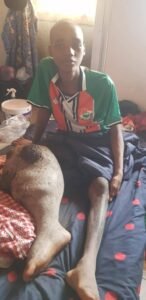 Coyah:S.O.S pour Fassou Frédéric Haba, 17 ans, dont les parents n'ont pas les moyens de financer son traitement.