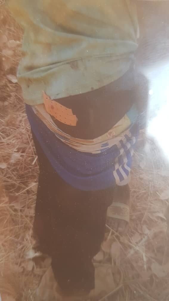 Siguiri : Trois blessés dans une attaque armée sur un site aurifère