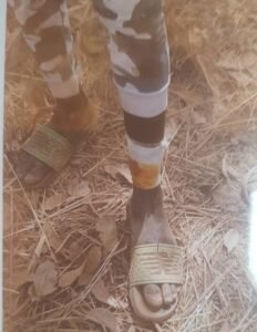 Siguiri : Trois blessés dans une attaque armée sur un site aurifère