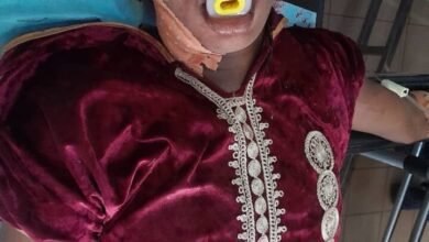 Siguiri : une jeune femme sauvagement agressée dans une auberge à Léro