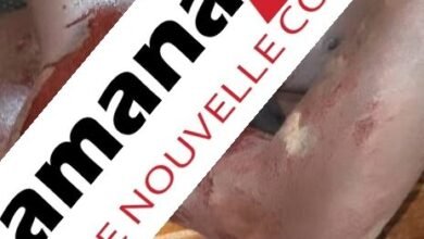 Siguiri : un jeune burkinabè grièvement blessé lors d’une attaque armée à Sèkè Madilah