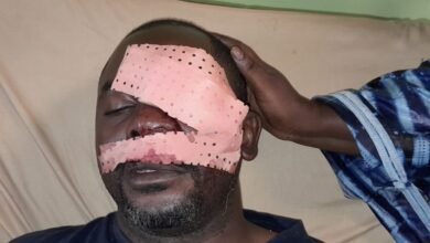 Un journaliste de la RTG violemment agressé à Conakry : il perd l’usage de son œil gauche