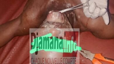 Siguiri : un élève de 18 ans meurt après avoir consommé de la drogue « Kuch » 6 Siguiri : un élève de 18 ans meurt après avoir consommé de la drogue « Kuch »