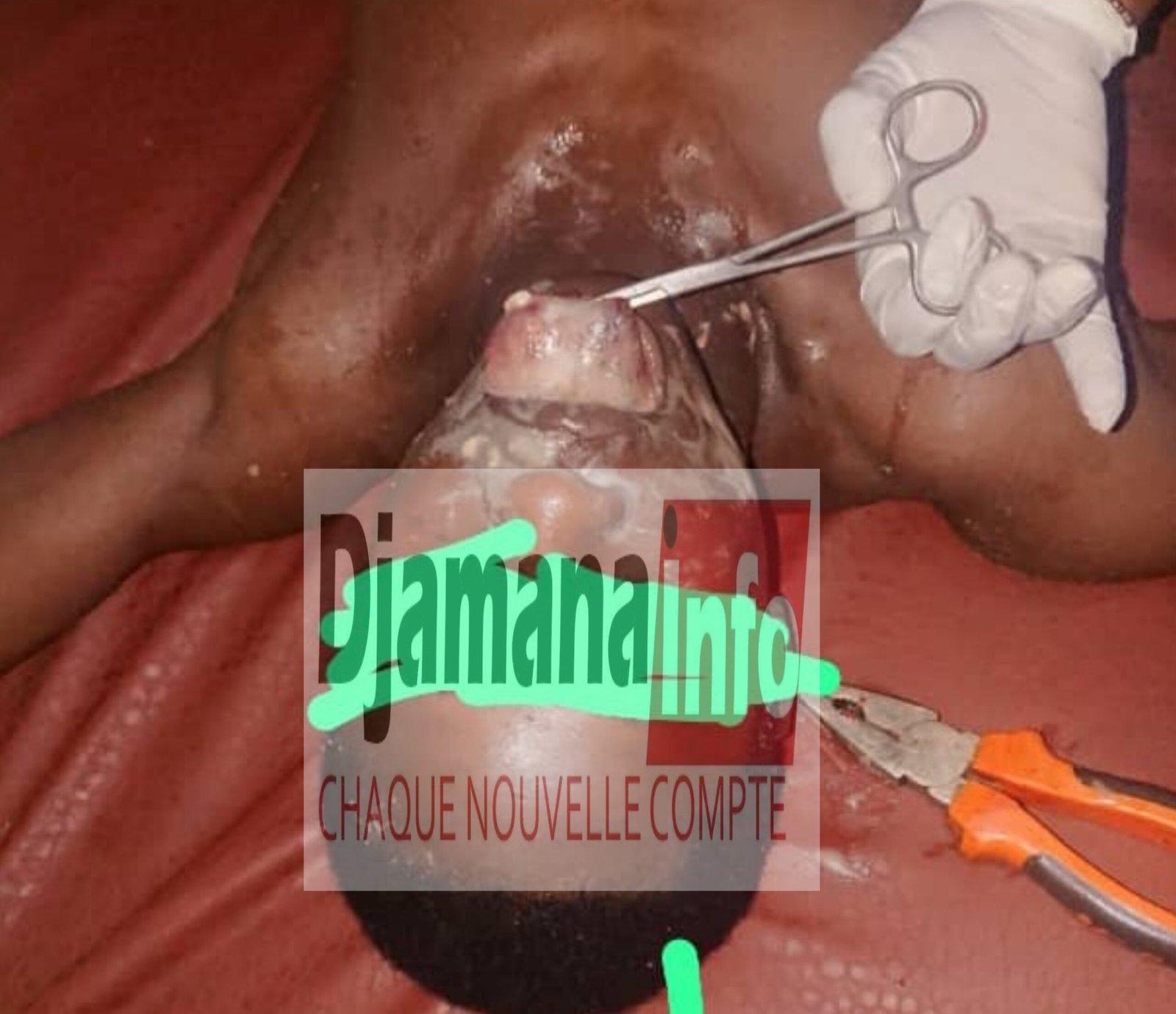 Siguiri : un élève de 18 ans meurt après avoir consommé de la drogue « Kuch »