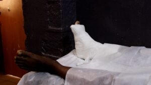 Kankan : « C’est ma moto qui me permettait de nourrir ma famille », père de famille grièvement blessé par balle