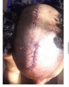 Insécurité à kindia : un jeune motard grièvement blessé lors d’une attaque nocturne entre wondy et sambaya