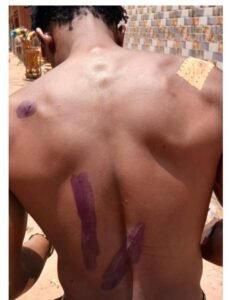 Insécurité à kindia : un jeune motard grièvement blessé lors d’une attaque nocturne entre wondy et sambaya