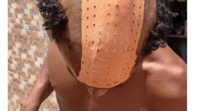 Insécurité à kindia : un jeune motard grièvement blessé lors d’une attaque nocturne entre wondy et sambaya