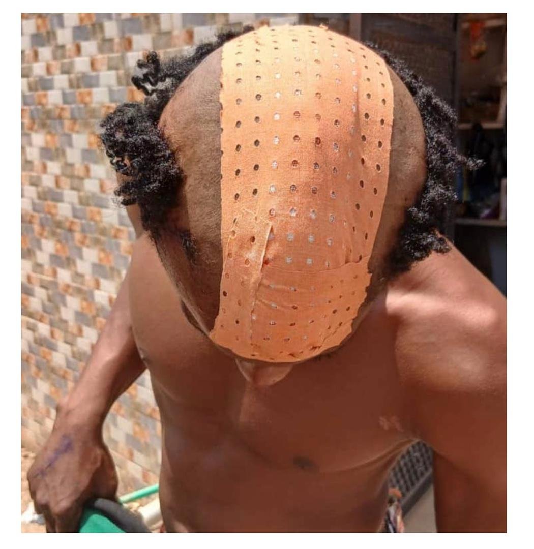 Insécurité à kindia : un jeune motard grièvement blessé lors d’une attaque nocturne entre wondy et sambaya