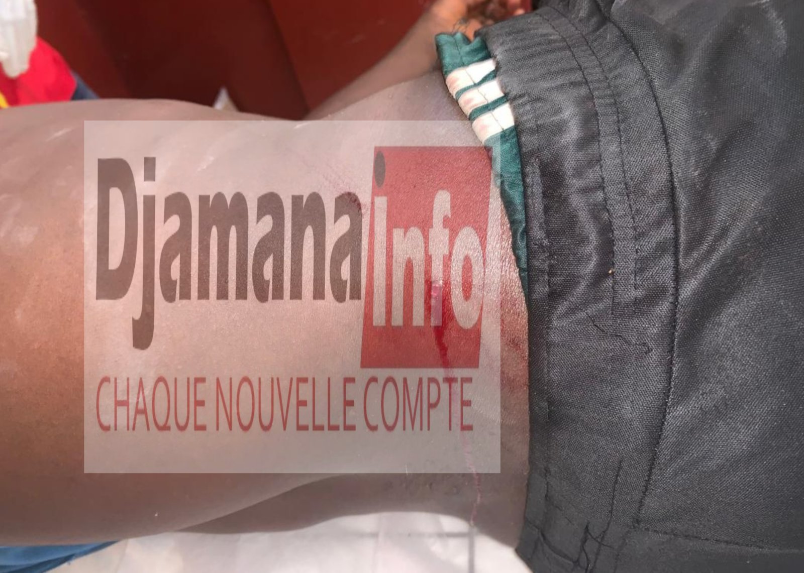 Kankan : des heurts à la frontière guinée–côte d’ivoire font plusieurs blessés par balle