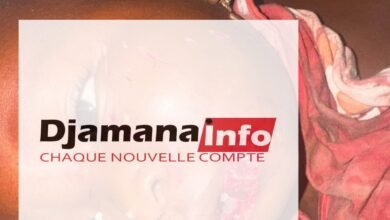 Siguiri : une fillette d’un an et demi blessée au visage, son père soupçonné d’être à l’origine des faits