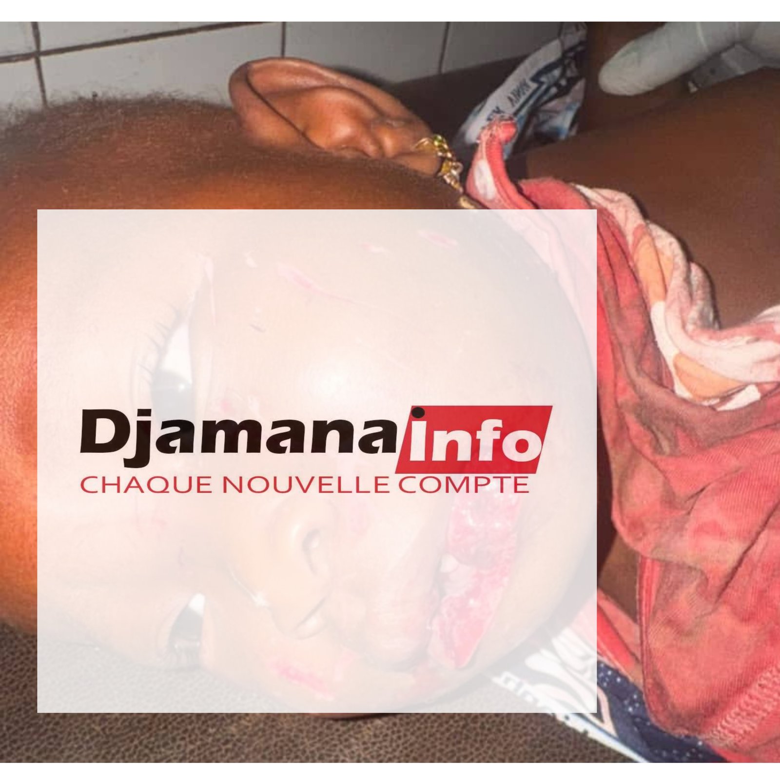 Siguiri : une fillette d’un an et demi blessée au visage, son père soupçonné d’être à l’origine des faits